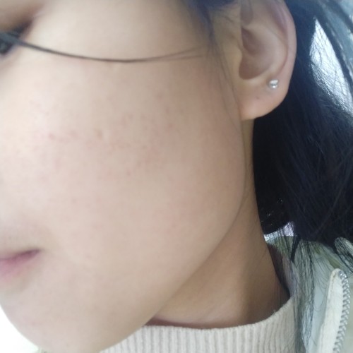 益膚醫(yī)用冷敷貼面膜怎么樣好不好，真實使用體驗(敏感肌必備)