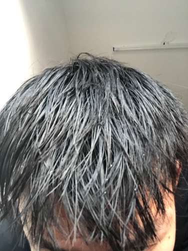 有情生姜洗發(fā)水是真的好有效嗎多少錢，防脫發(fā)效果親測(cè)(僅19.9元)